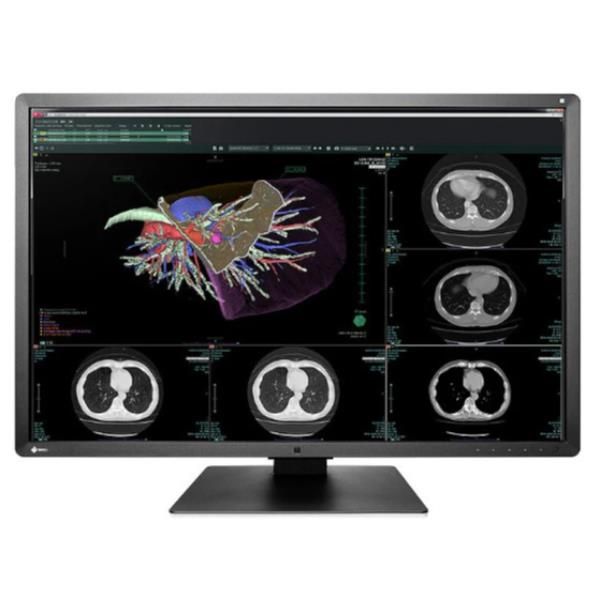 EIZO RadiForce RX660 - Monitor a LED - 6MP - colore - 30" - 3280 x 2048 - IPS -…